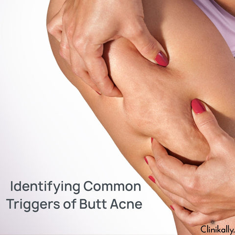 Identifying Common Triggers of Butt Acne