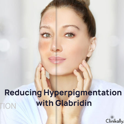 Reducing Hyperpigmentation with Glabridin