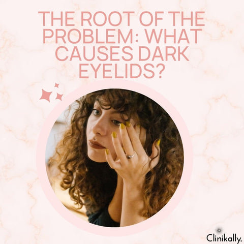 The Root of the Problem: What Causes Dark Eyelids?