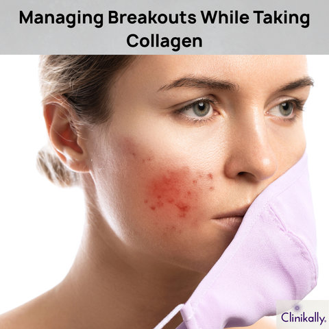 Managing Breakouts While Taking Collagen
