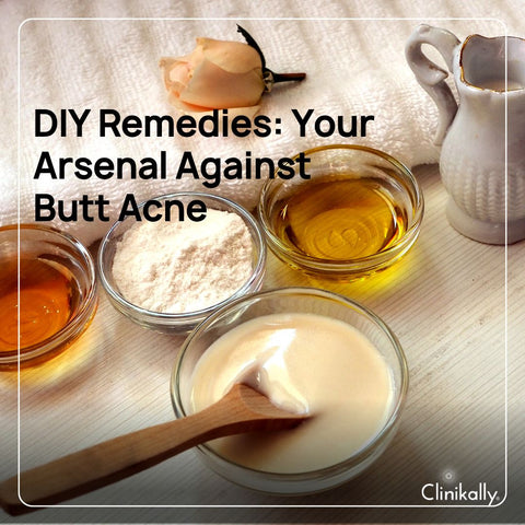 DIY Remedies: Your Arsenal Against Butt Acne