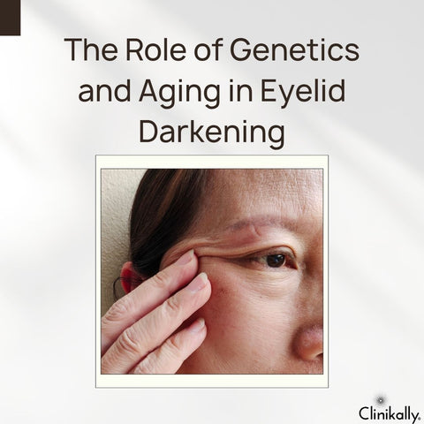 The Role of Genetics and Aging in Eyelid Darkening