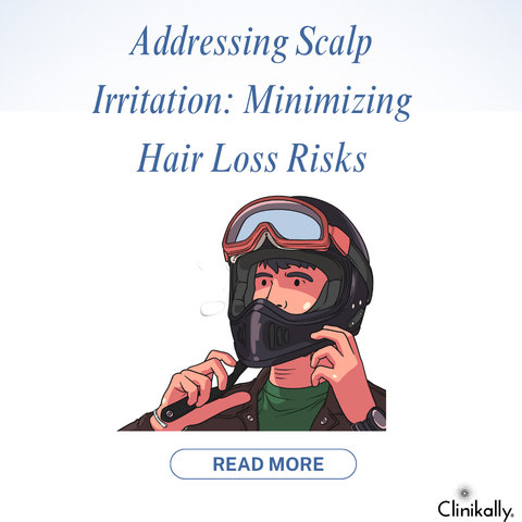 Addressing Scalp Irritation: Minimizing Hair Loss Risks