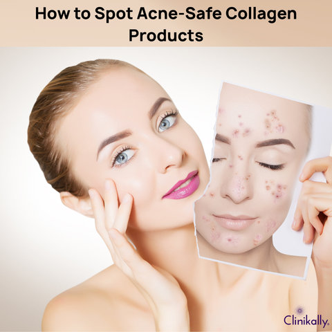 How to Spot Acne-Safe Collagen Products