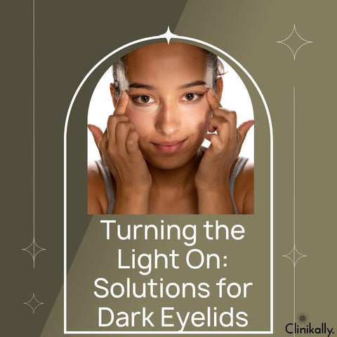 Turning the Light On: Solutions for Dark Eyelids