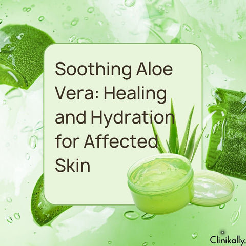 Soothing Aloe Vera: Healing and Hydration for Affected Skin