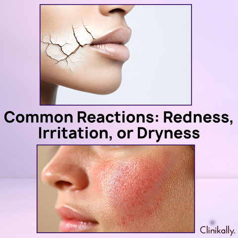 Common Reactions: Redness, Irritation, or Dryness