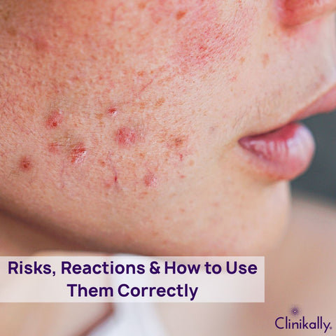 Risks, Reactions &amp; How to Use Them Correctly