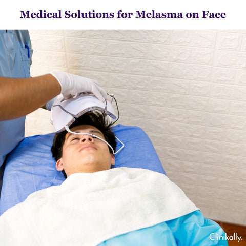 Medical Treatments for Melasma on Face