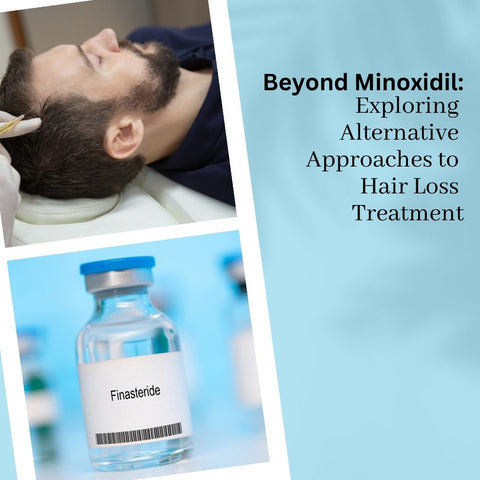 Beyond Minoxidil: Exploring Alternative Approaches to Hair Loss Treatment