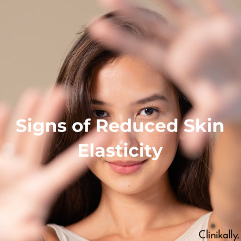 Signs of Reduced Skin Elasticity