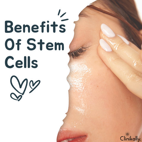 Benefits Of Stem Cells
