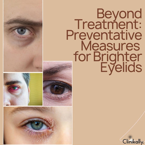 Beyond Treatment: Preventative Measures for Brighter Eyelids