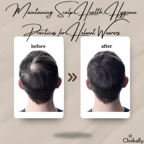 Maintaining Scalp Health: Hygiene Practices for Helmet Wearers