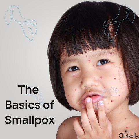 The Basics of Smallpox