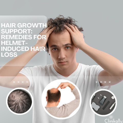 Hair Growth Support: Remedies for Helmet-Induced Hair Loss
