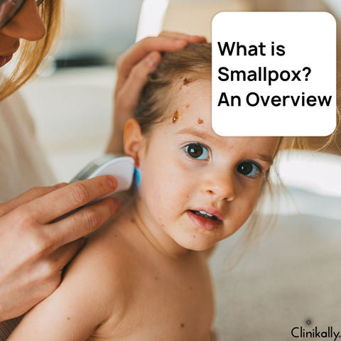 What is Smallpox? An Overview
