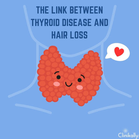 The Link Between Thyroid Disease and Hair Loss