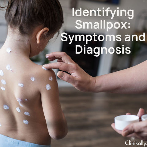 Identifying Smallpox: Symptoms and Diagnosis