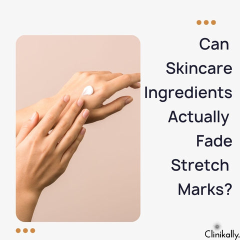 Can Skincare Ingredients Actually Fade Stretch Marks?