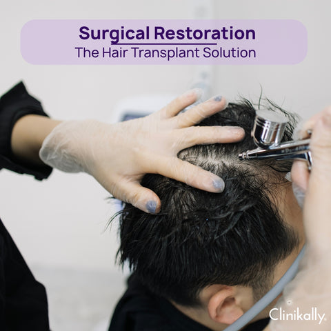Surgical Options for Hair Restoration