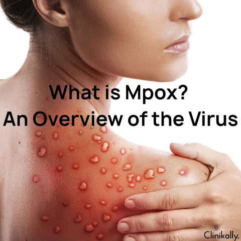 What is Mpox? An Overview of the Virus