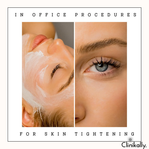 In-Office Procedures for Skin Tightening