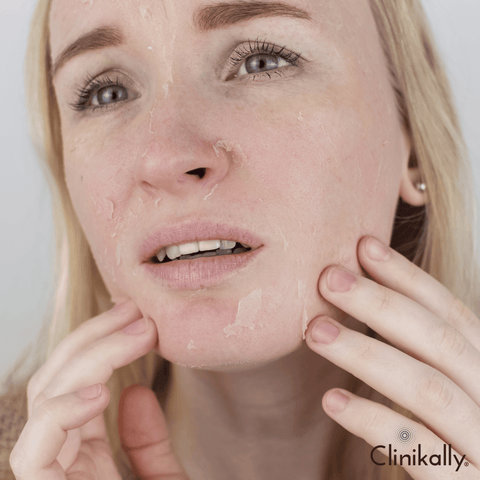 Retinol for dry skin