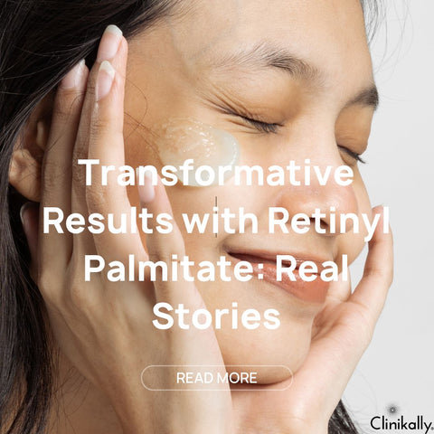 Transformative Results with Retinyl Palmitate: Real Stories