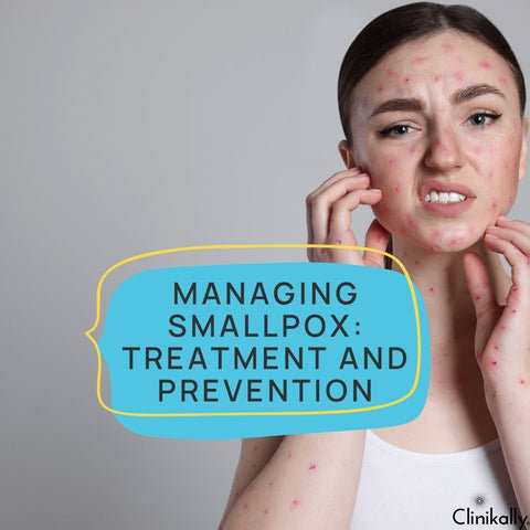 Managing Smallpox: Treatment and Prevention