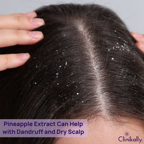 How Pineapple Extract Can Help with Dandruff and Dry Scalp
