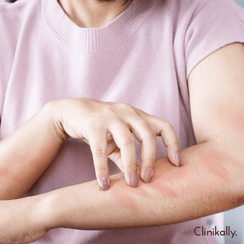 Are There Any Side Effects of Using Alpha Arbutin?