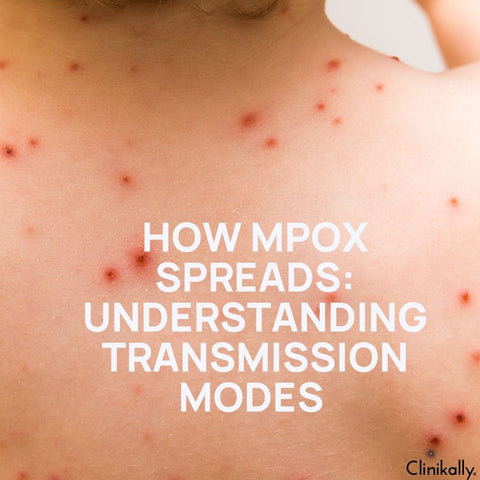 How Mpox Spreads: Understanding Transmission Modes