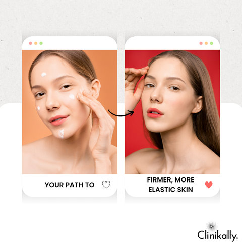 Conclusion: Your Path to Firmer, More Elastic Skin