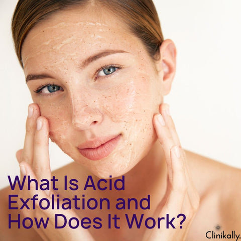 What Is Acid Exfoliation and How Does It Work?