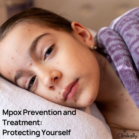 Mpox Prevention and Treatment: Protecting Yourself
