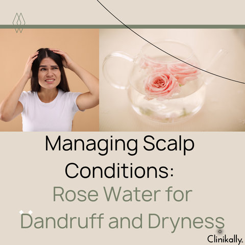 Managing Scalp Conditions: Rose Water for Dandruff and Dryness