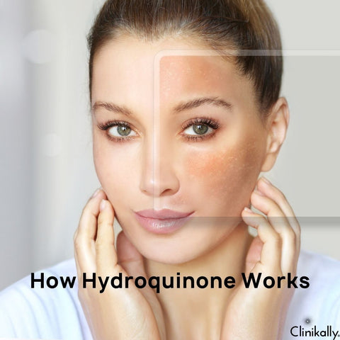 How Hydroquinone Works
