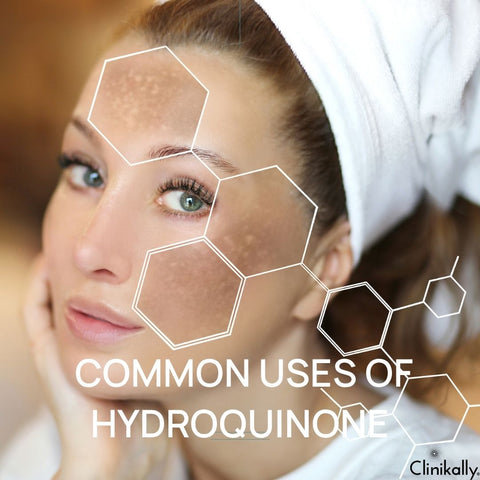Common Uses of Hydroquinone