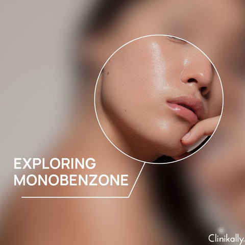 Exploring Monobenzone