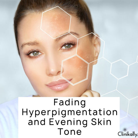 Fading Hyperpigmentation and Evening Skin Tone