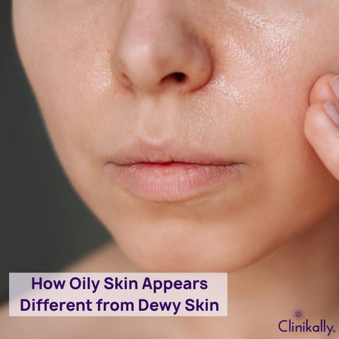 How Oily Skin Appears Different from Dewy Skin