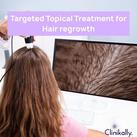 Targeted Topical Treatment for Hair regrowth