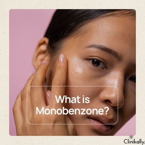 What is Monobenzone?