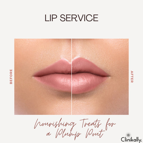 Lip Service: Nourishing Treats for a Plump Pout