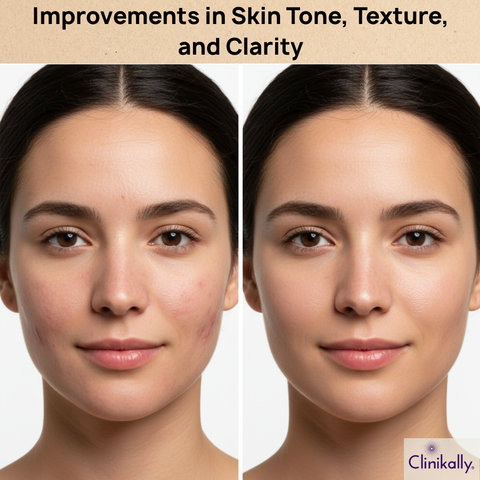 Improvements in Skin Tone, Texture, and Clarity