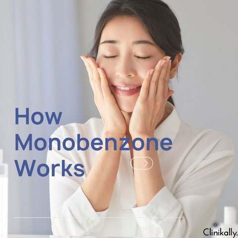 How Monobenzone Works