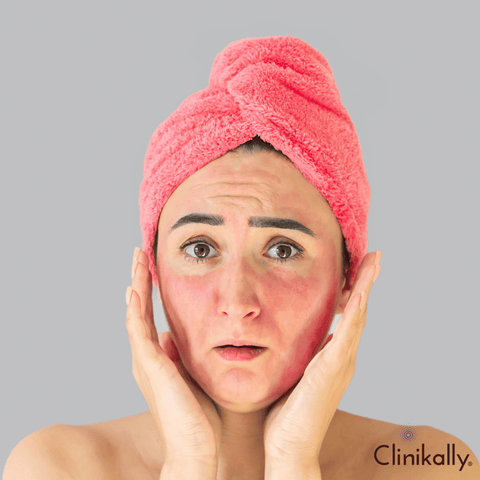 Potential Side Effects of Benzoyl Peroxide