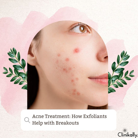 Acne Treatment: How Exfoliants Help with Breakouts