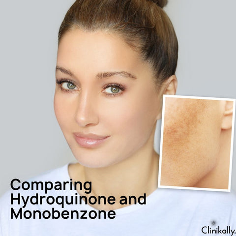 Comparing Hydroquinone and Monobenzone